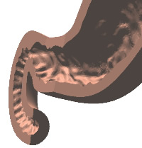 十二指腸付近の胃袋切断面